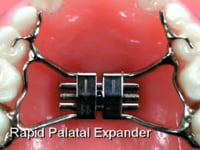 RPE Description