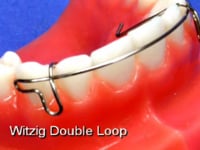 Witzig Labial Bow Description