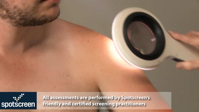 What to expect from your full body skin check appointment: Holly
