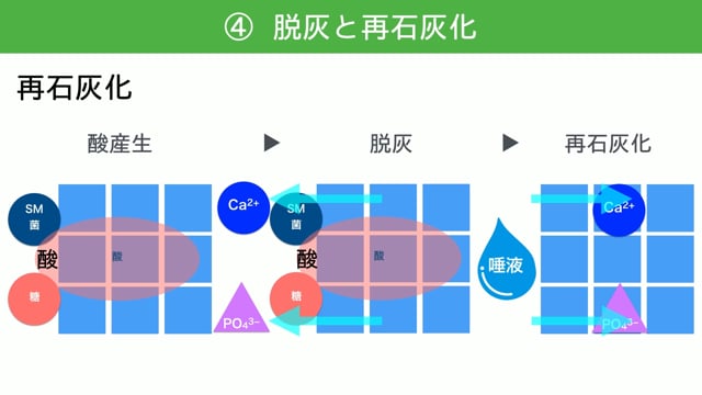 【Education Library】う蝕の発生機序について