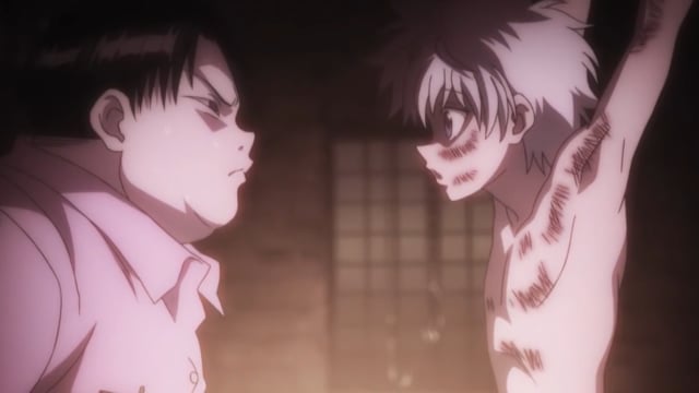 Killua Torture Scene   English Dub