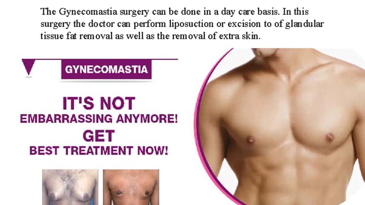Male Chest Reshaping Surgery in Delhi IndiaÂ