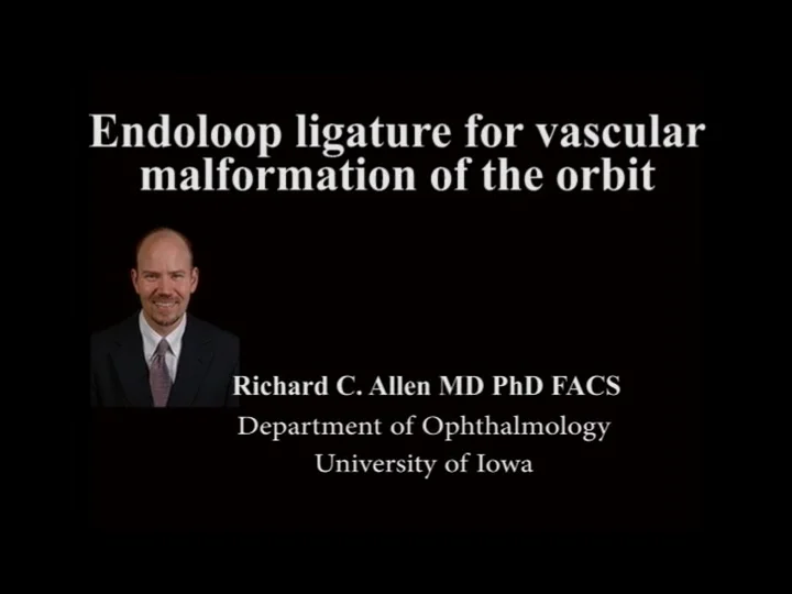 Endoloop ligature for vascular malformation of the orbit