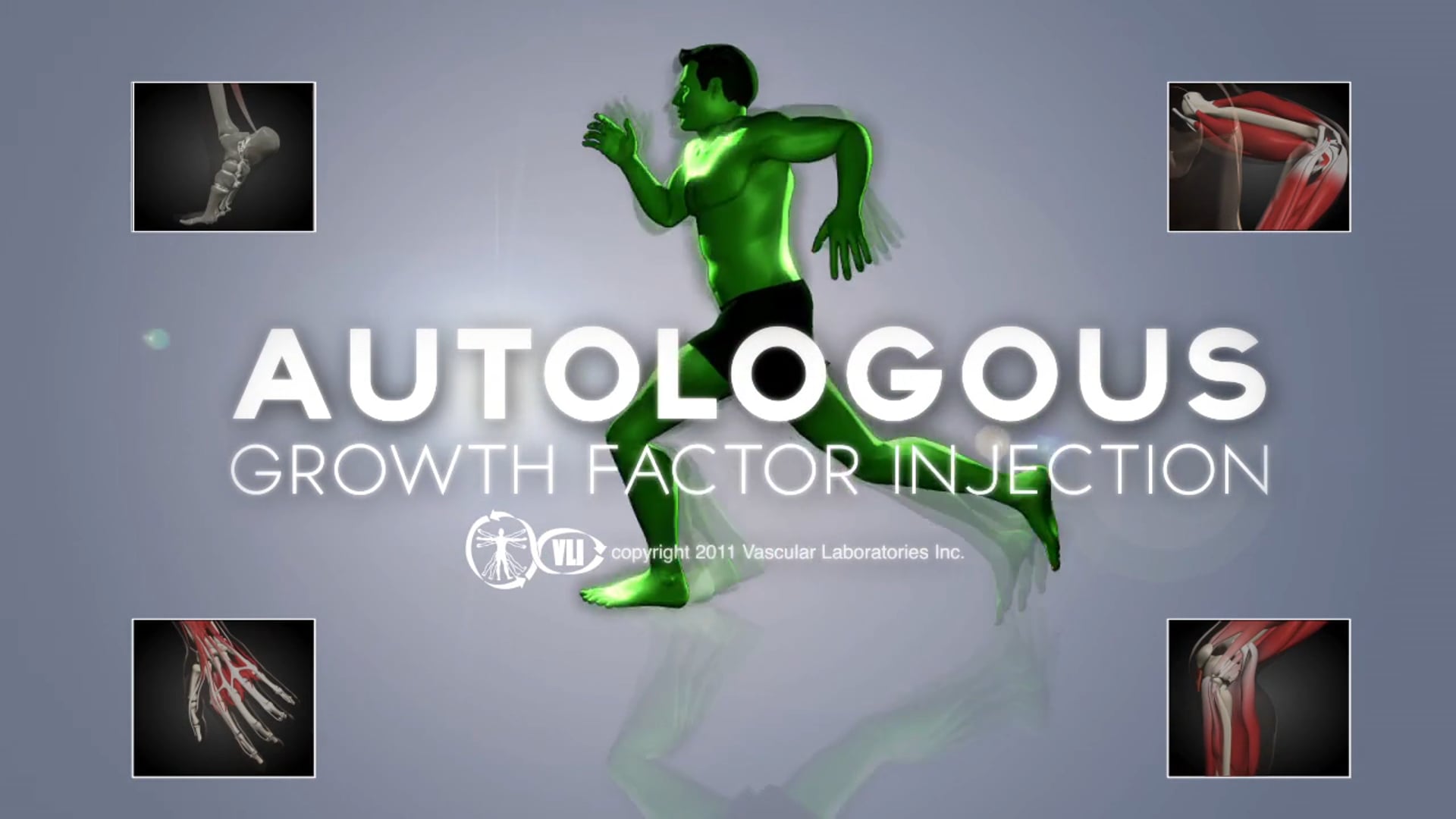 Autologous Growth Factor Injection (2010) Directed by Jose A. Acosta for VLI.