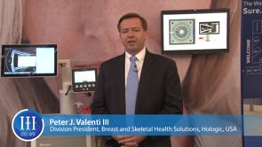 What other products does Hologic have in the pipeline, I-I-I Video with Peter J. Valenti, Hologic, USA