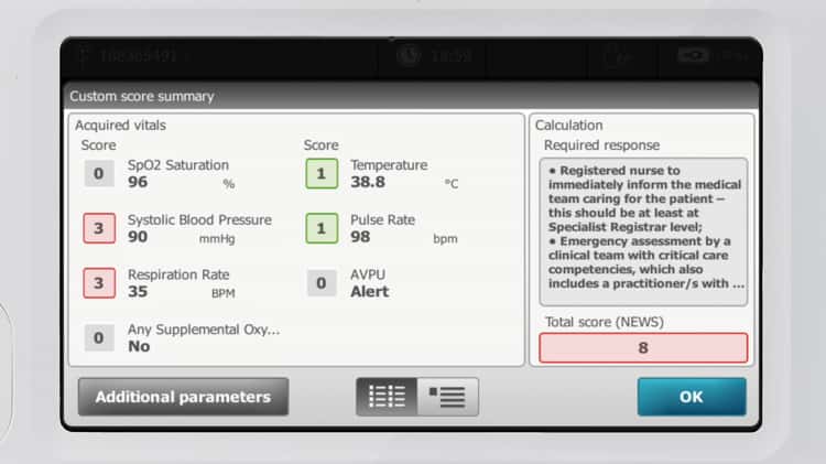 Connex Spot Monitor Blood Pressure Include: Braun Pro6000