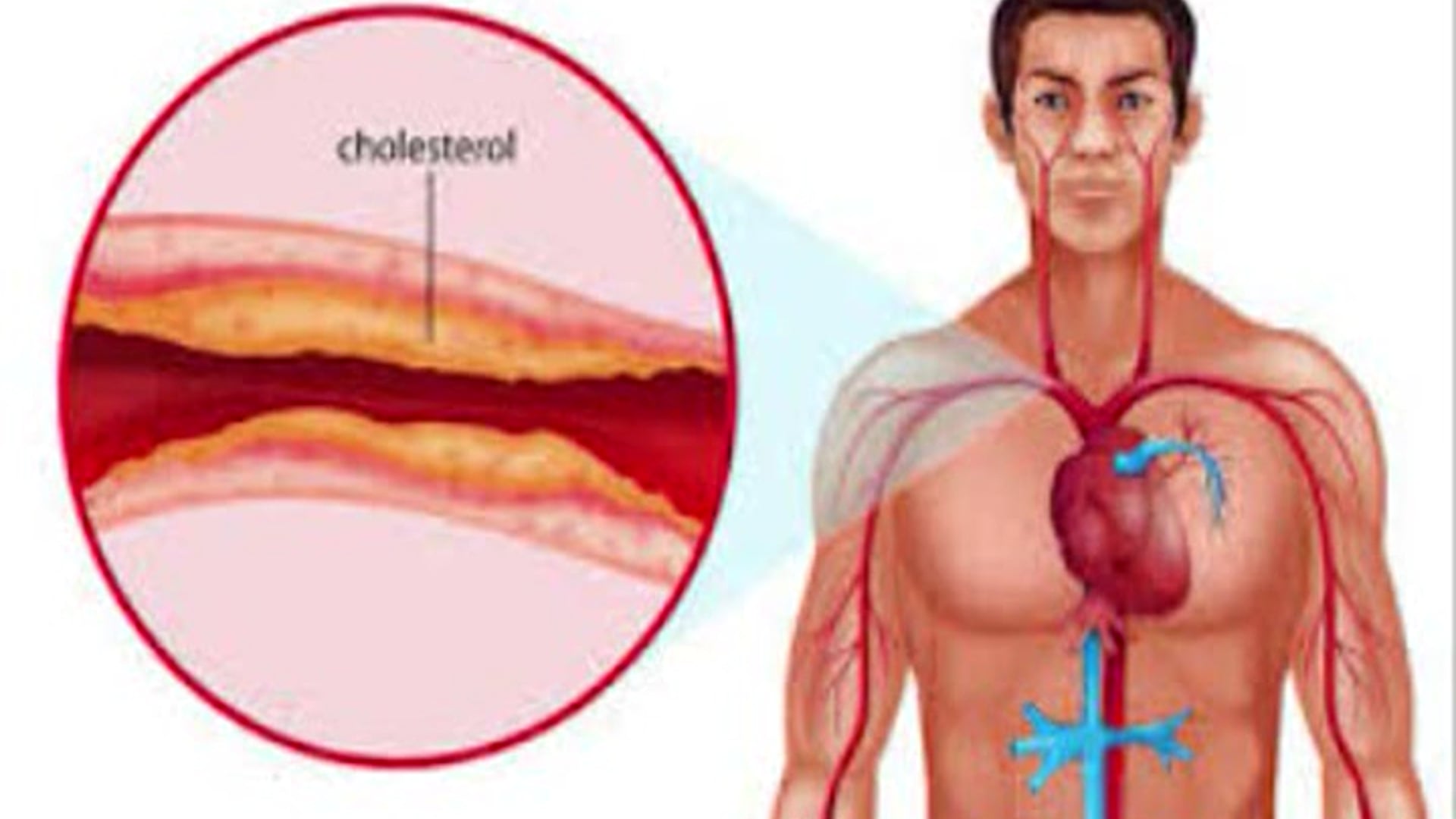 Cholesterol i statyny - nieznane fakty