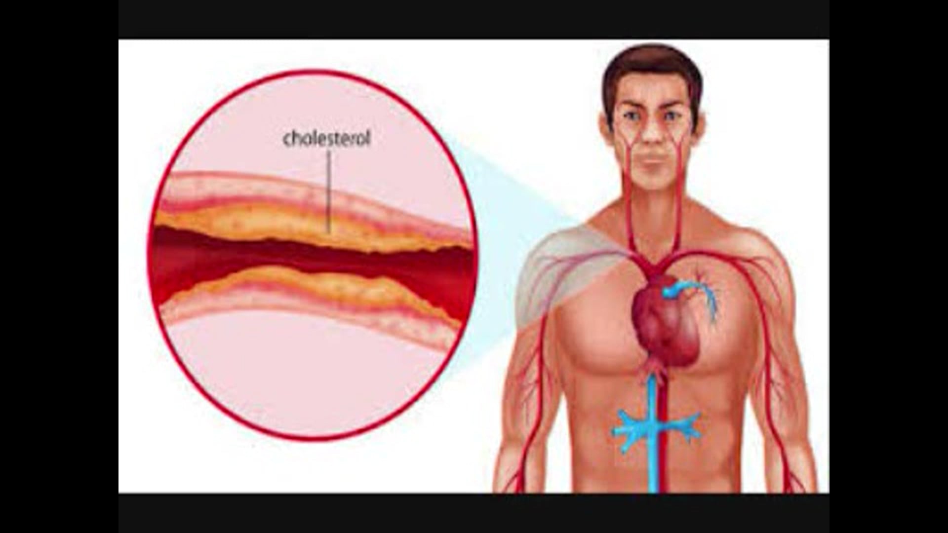 Cholesterol i statyny - nieznane fakty