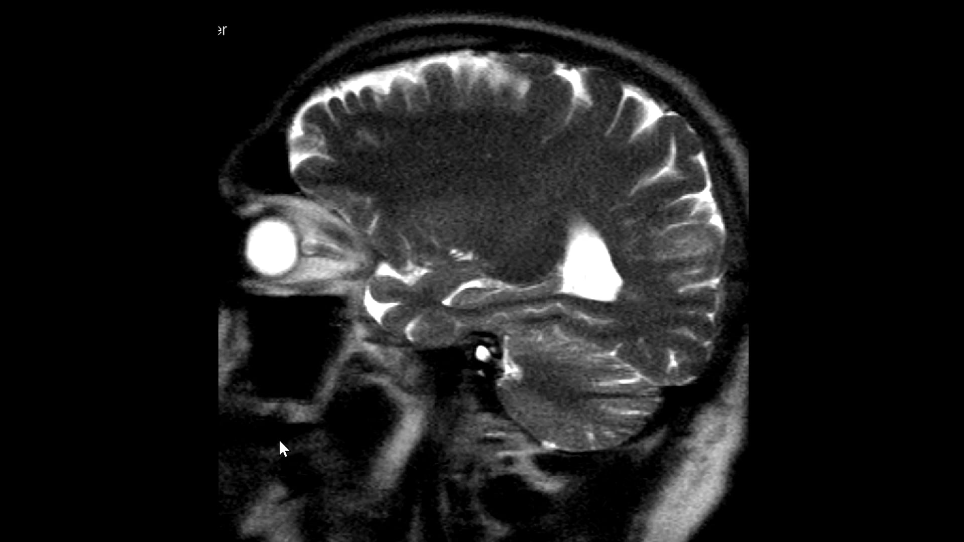 The Bilderberg Group - Fake Plastic Heads - Official MRI Scan Music ...