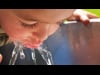 Fluoride Varnish- English