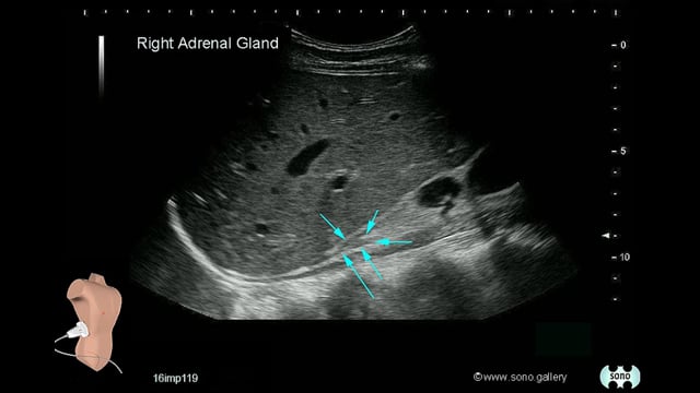 adrenal gland