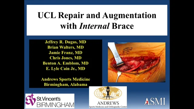 Tommy John Surgery (UCL Injury) - Motus Physical Therapy