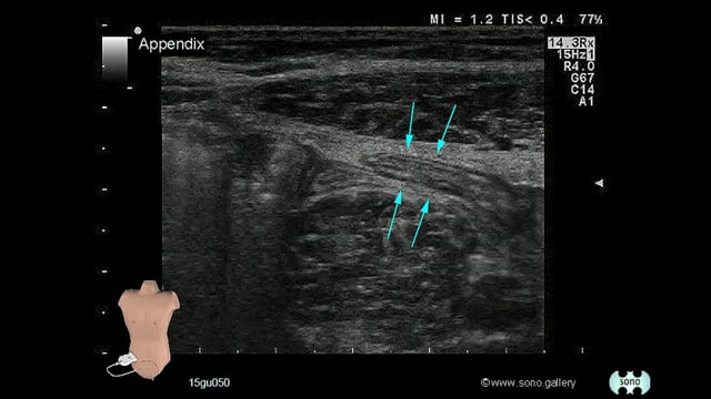 Appendix
