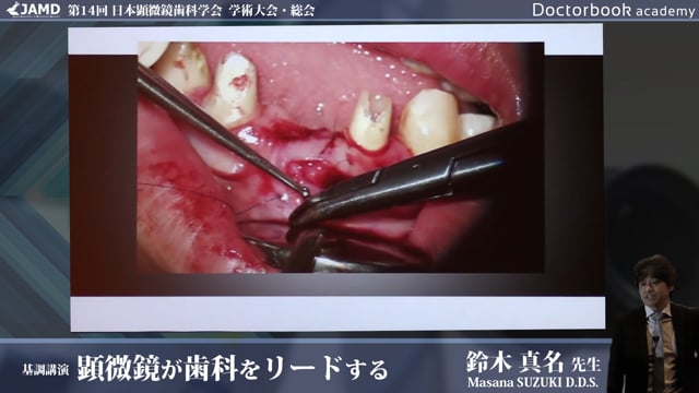 第14回 日本顕微鏡歯科学会 学術大会 基調講演 