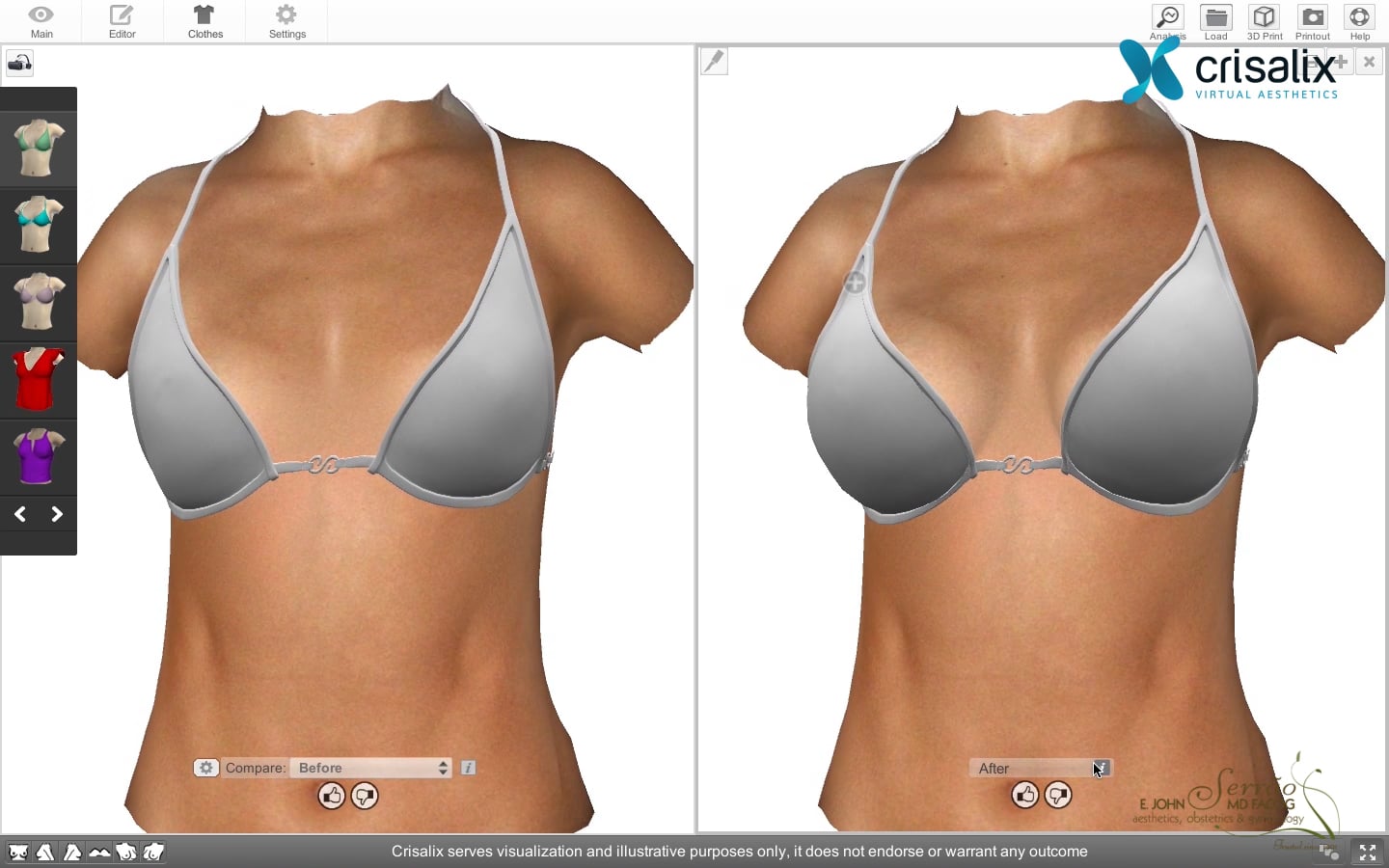 Увеличивающийся в размерах в воде. Компьютерное моделирование груди. 3 Д моделирование груди. 3d моделирование груди. Увеличение груди моделирование.