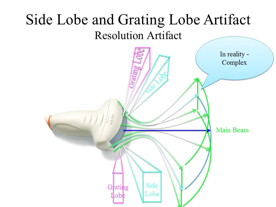 Side Lobe And Grating Lobe Artifact On Vimeo