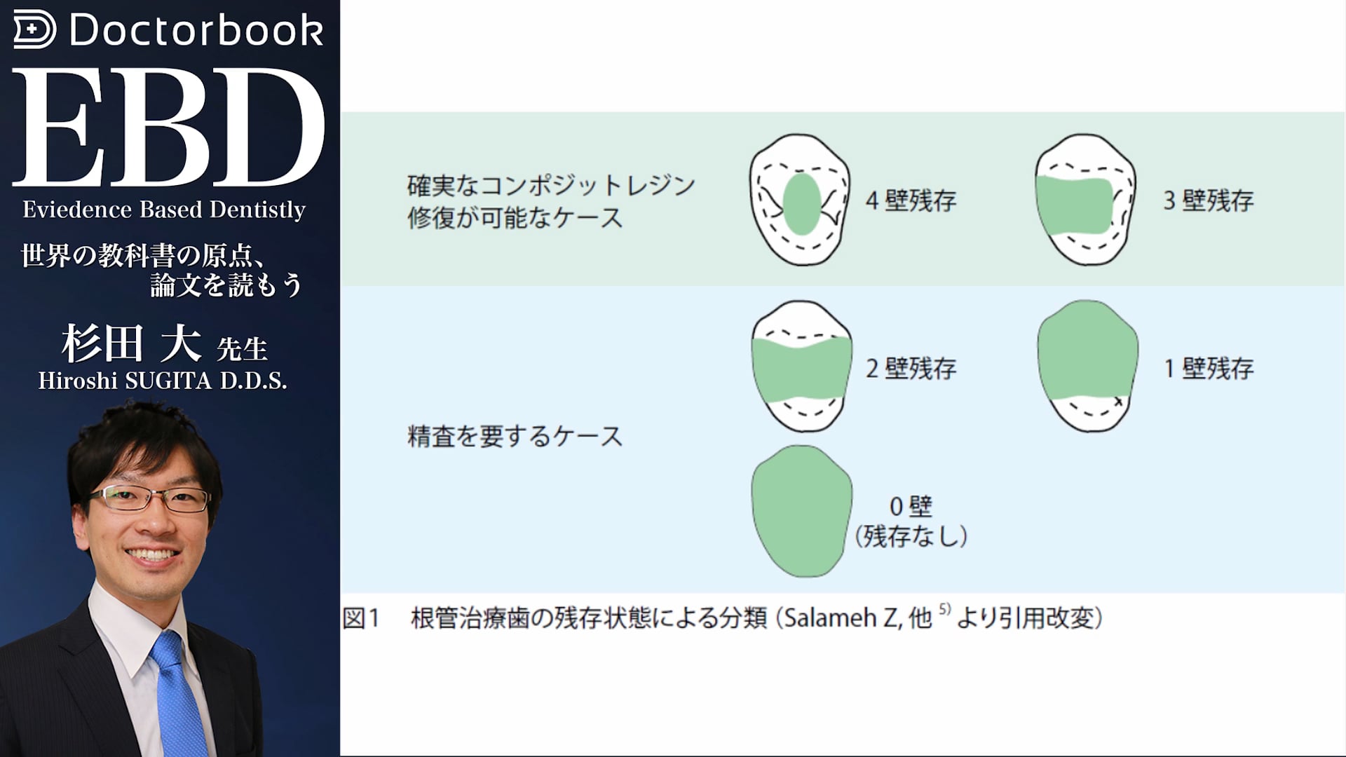 う蝕治療ガイドライン #5