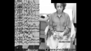 Juvenile myoclonic epilepsy (1)
