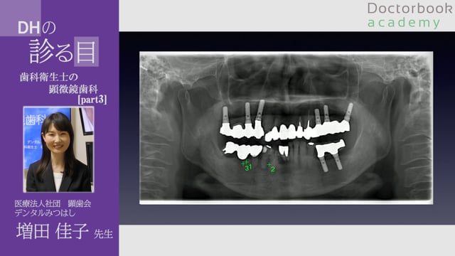 【EYE】歯科衛生士の顕微鏡歯科 #3