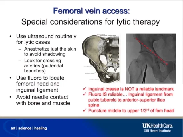 Piedmont Healthcare LV Myocardial Strain Workflow on Siemens SC200 on Vimeo