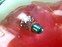 Micro screw Dental Appliance