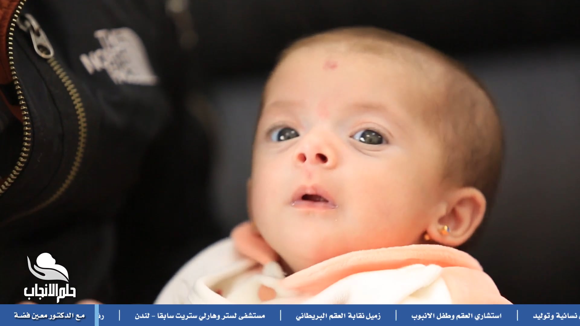 حلقة الاسقاطات المتكررة