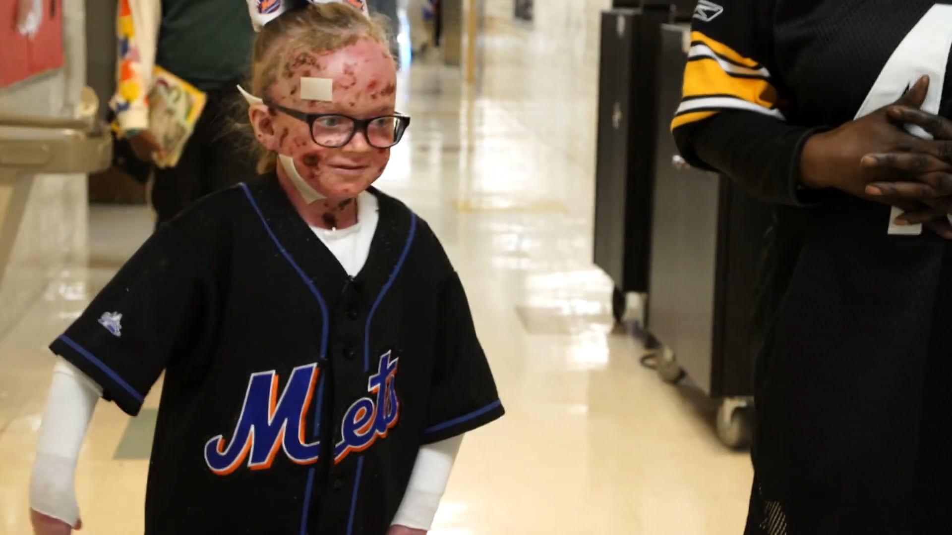 Meet Ella Murray: The 9-year-old with skin as delicate as a butterfly's wing