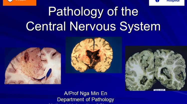 Central Nervous System Anatomy: Overview, Gross Anatomy