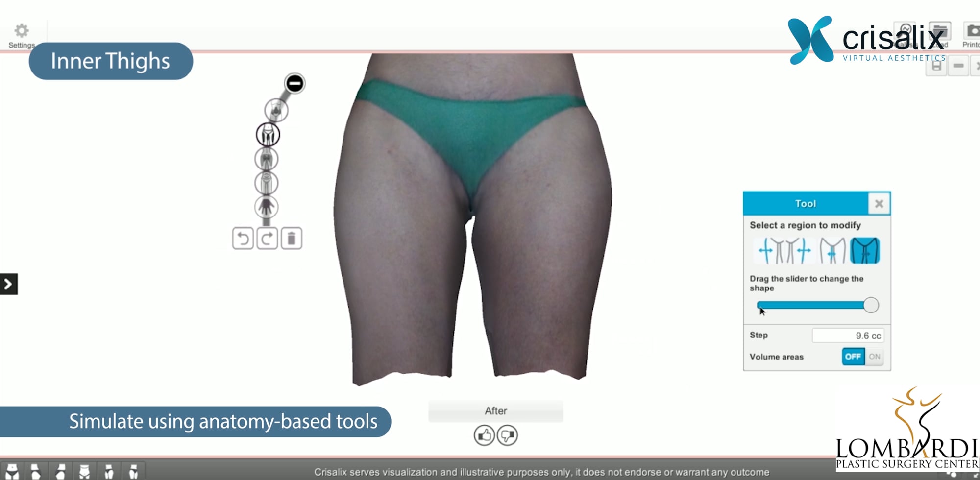 Dr. Anthony Lombardi Simulation of Body Procedures on Vimeo