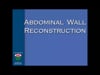 Dr. James Clune- ABDOMINAL WALL RECONSTRUCTION- 35 min- 2017