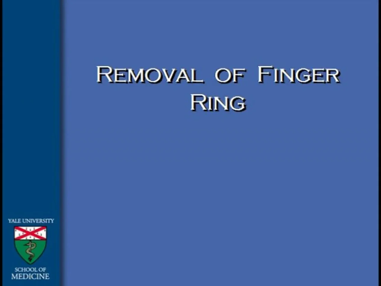 OPERATIVE PROCEDURES - Dr  Stephan Ariyan- RING REMOVAL