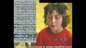 Typical absence seizures of childhood absence epilepsy (1)