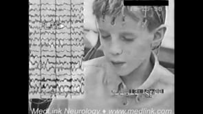 Typical absence seizures of childhood absence epilepsy (2)