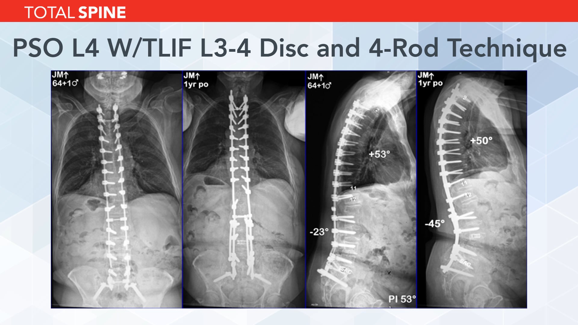 Multi-rod Reconstruction