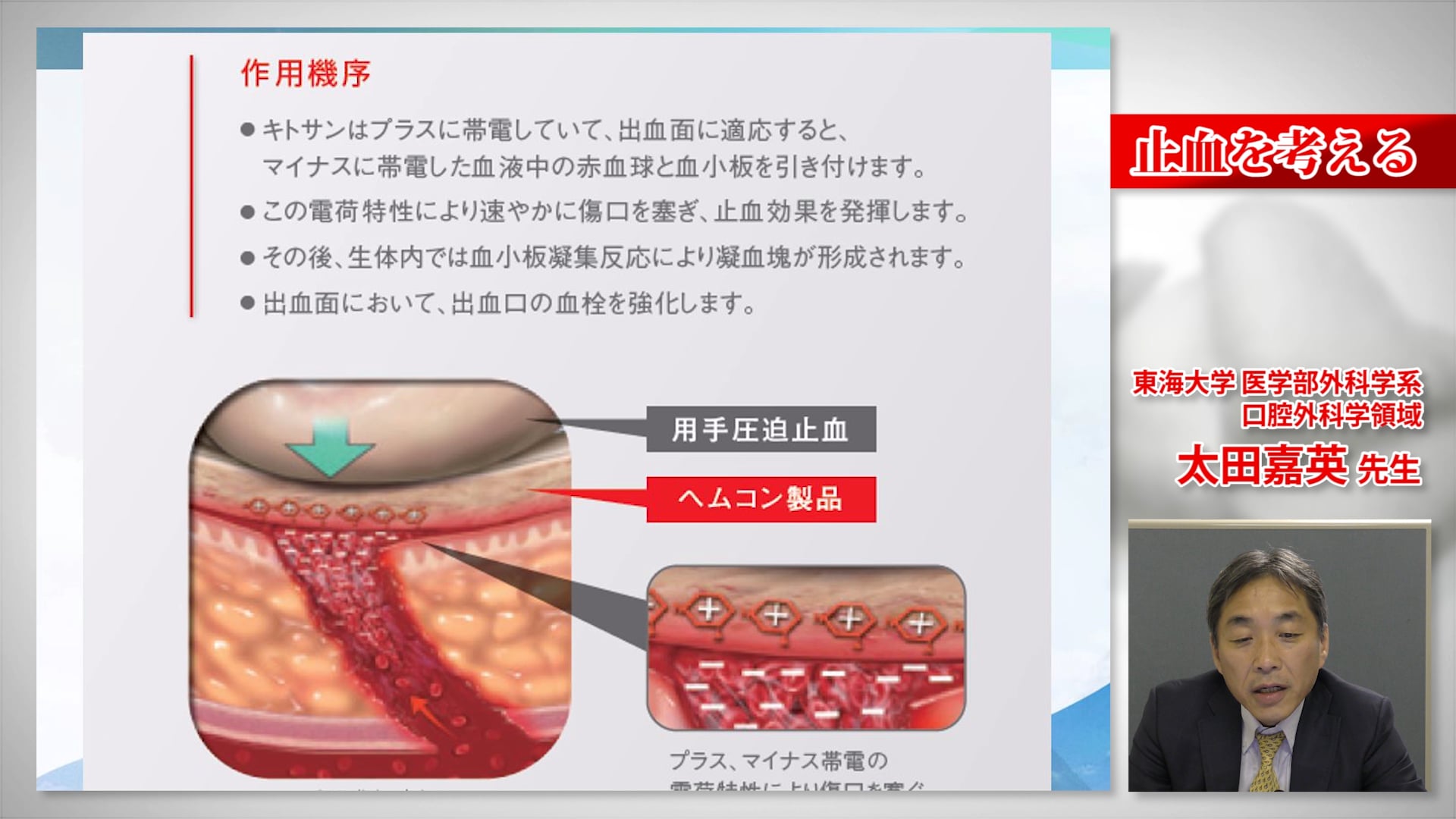 止血を考える