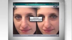 Watch Dermatology Treatments Montclair NJ - Men and Women Skin Care