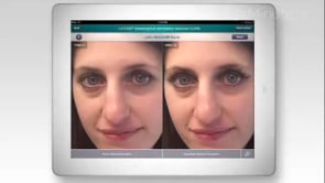 Watch Dermatology Treatments Montclair NJ - Men and Women Skin Care
