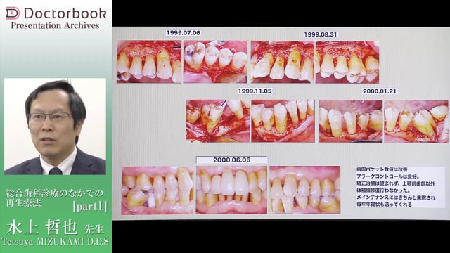 日本包括歯科臨床学会特別講演「2つの咬合論」 | Doctorbook academy 