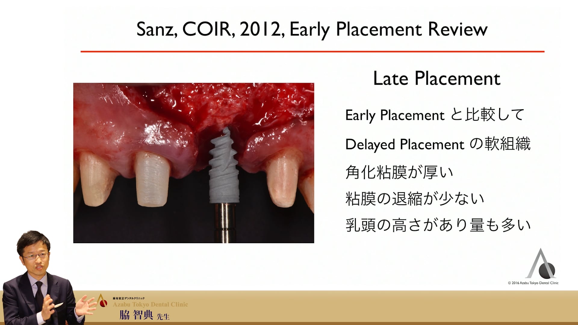 Part9【参加者専用】脇智典先生 審美領域のインプラント～歯頸線を綺麗に保つキーポイント～ 