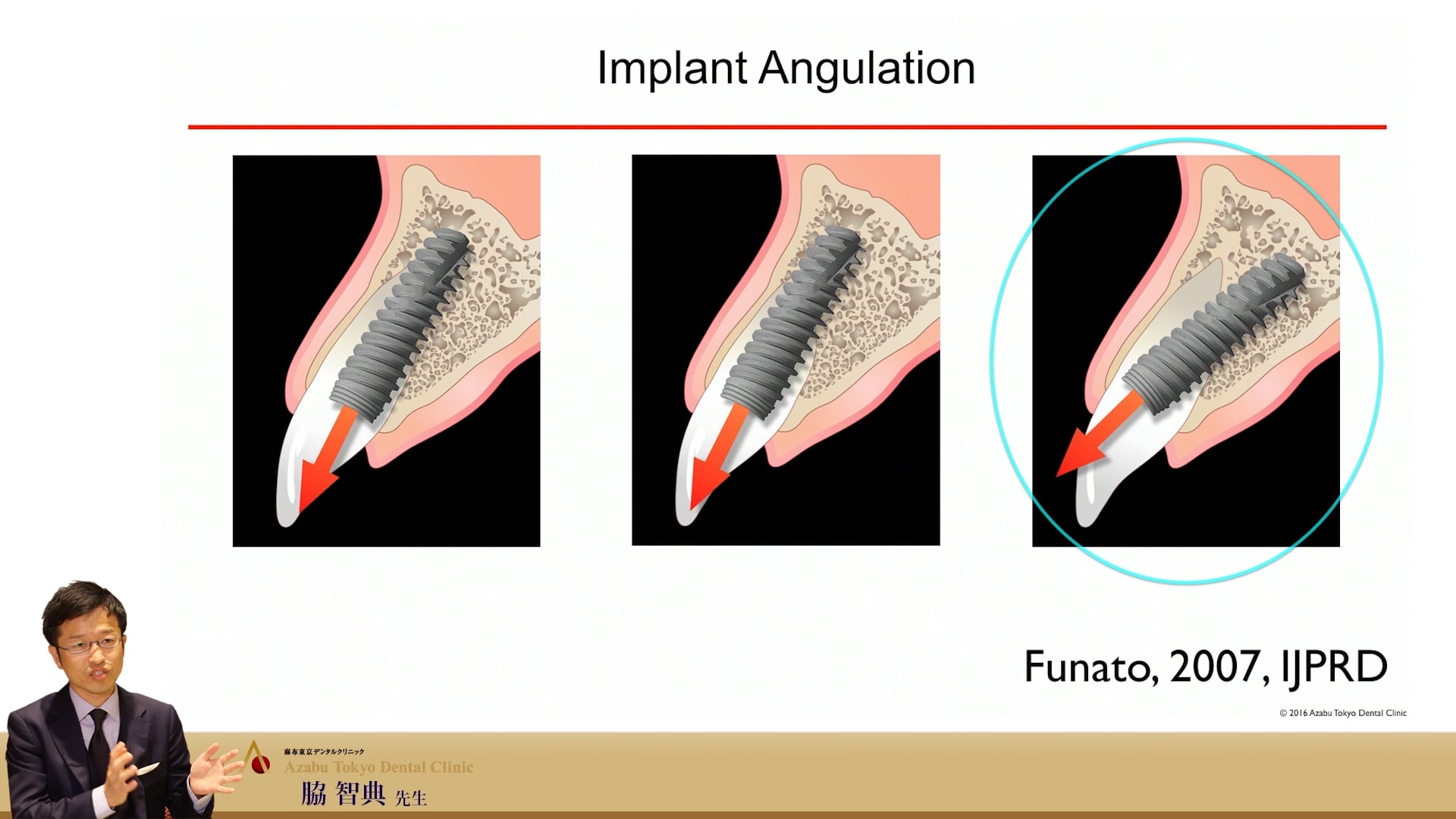 #4 Diagnosis of CT X-Ray & Bone sounding