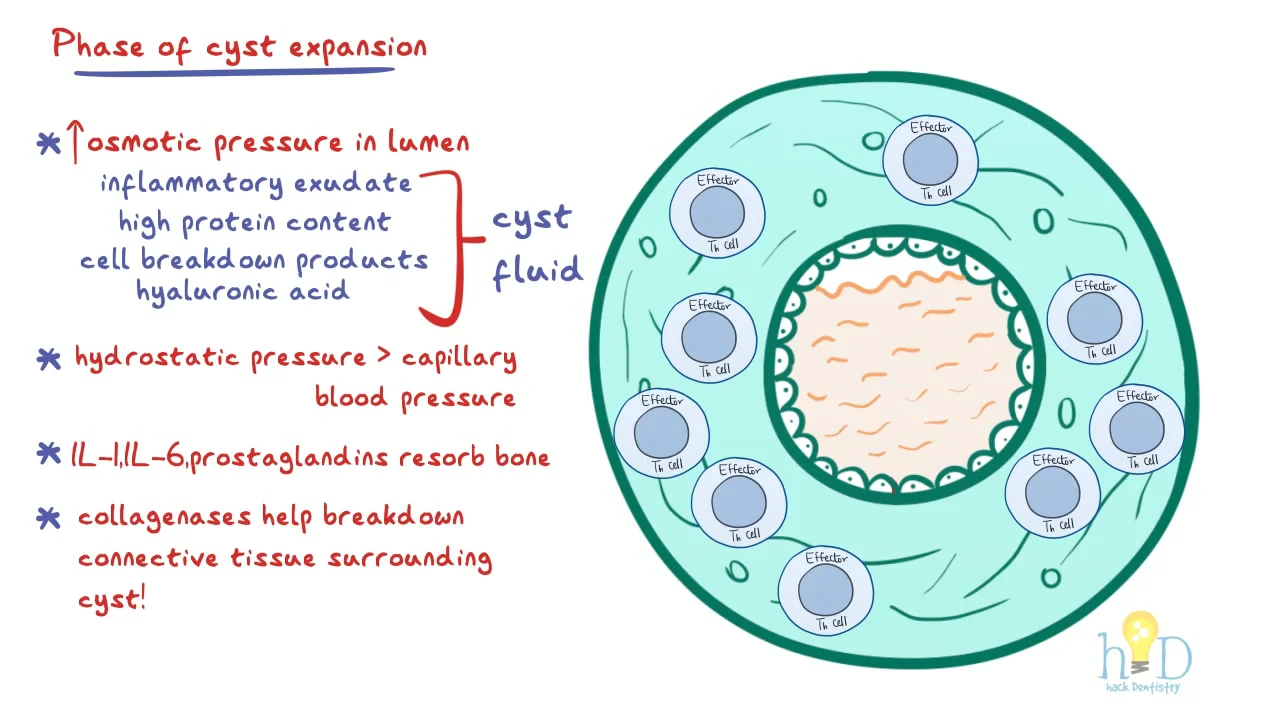 Radicular Cyst - Pathogenesis on Vimeo