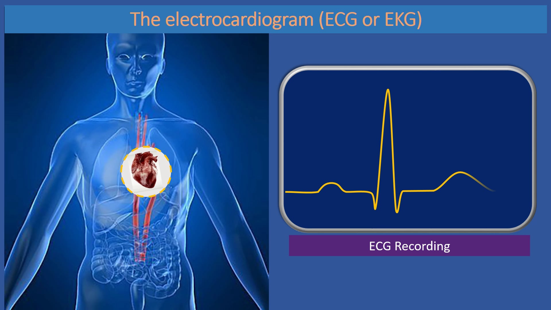 The Electrocardiogram (ECG) on Vimeo