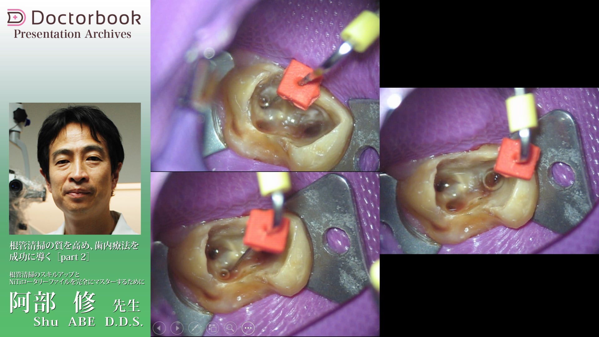 根管清掃のスキルアップ #2