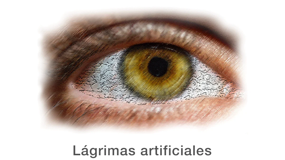 Mujer Con Ojos Secos Aplicando Lágrimas Artificiales En Invierno Imagen de  archivo - Imagen de farmacéutico, cierre: 202177031