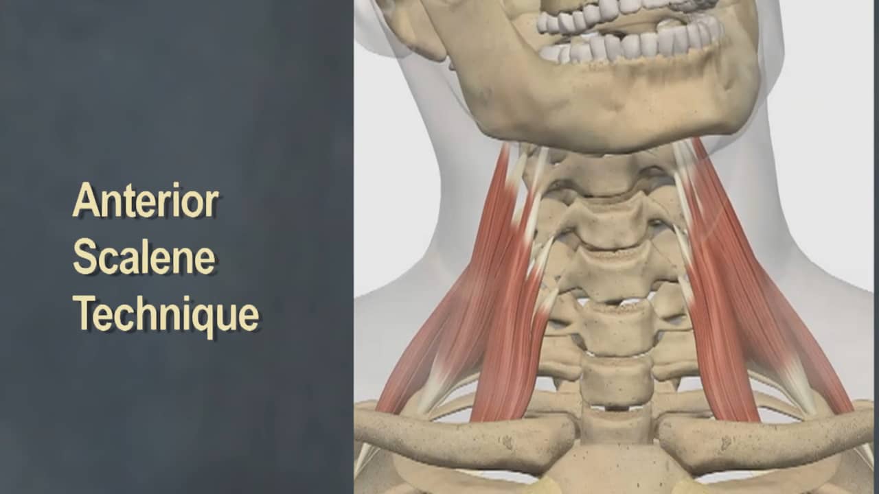 TT Anterior Scalene Release on Vimeo