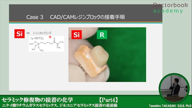 #4 CAD/CAM接着・まとめ