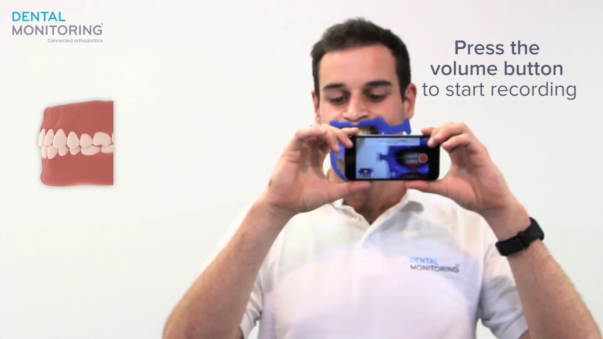 Dental-Monitoring-Video-exam-tutorial-ALIGNERS.v2.99