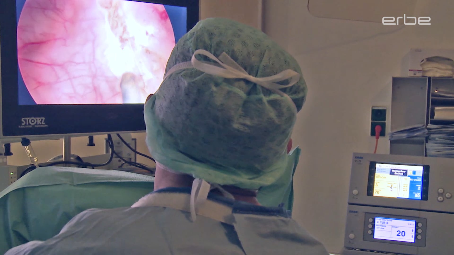 En bloc resection of bladder tumors with HybridKnife