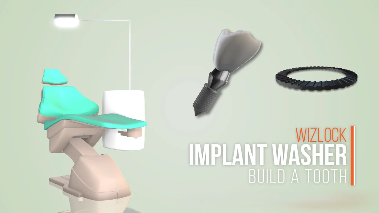 wizlock dental implant washer main trailer on Vimeo