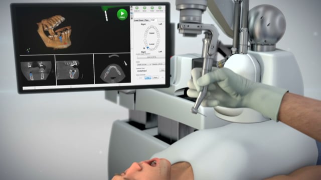 Play Yomi® Overview - Robot Assisted Dental Surgery